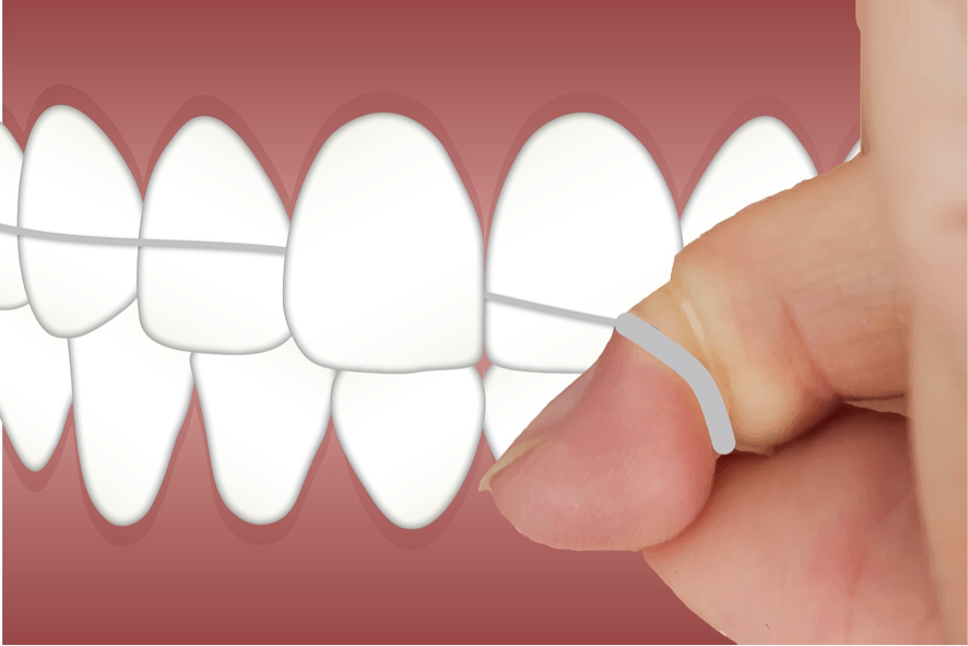 Los beneficios del hilo dental] - Clínica Dental Sonríe